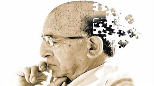 Bệnh Alzheimer là một loại bệnh tiến triển ngày càng nặng dần với đặc điểm là sự hủy diệt từ từ các tế bào thần kinh trong não