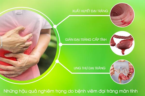 Những hậu quả nghiêm trọng do bệnh viêm đại tràng mãn tính gây ra