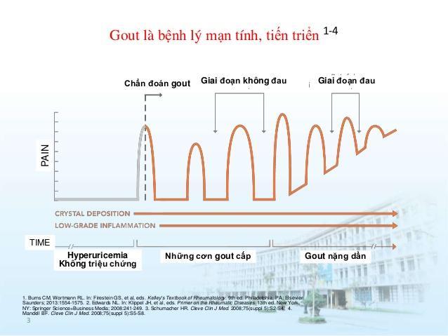 Các giai đoạn tiến triển của bệnh Gút