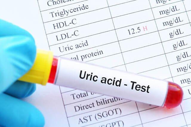 Cách làm giảm acid uric trong máu hiệu quả là gì?