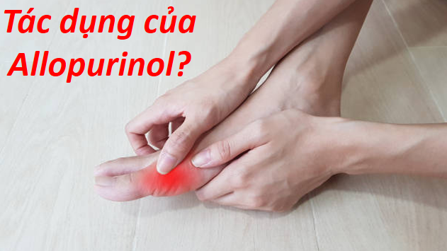 Tác dụng của thuốc tây với người bệnh gút và những lưu ý khi sử dụng